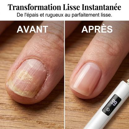 Appareil Professionnel pour Réparer, Façonner et Polir les Ongles