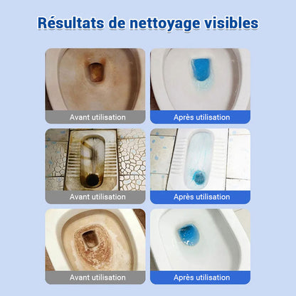 ✨🚽 Tablettes effervescentes nettoyantes pour toilettes – détartrage et décontamination, élimination des dépôts urinaires et des odeurs
